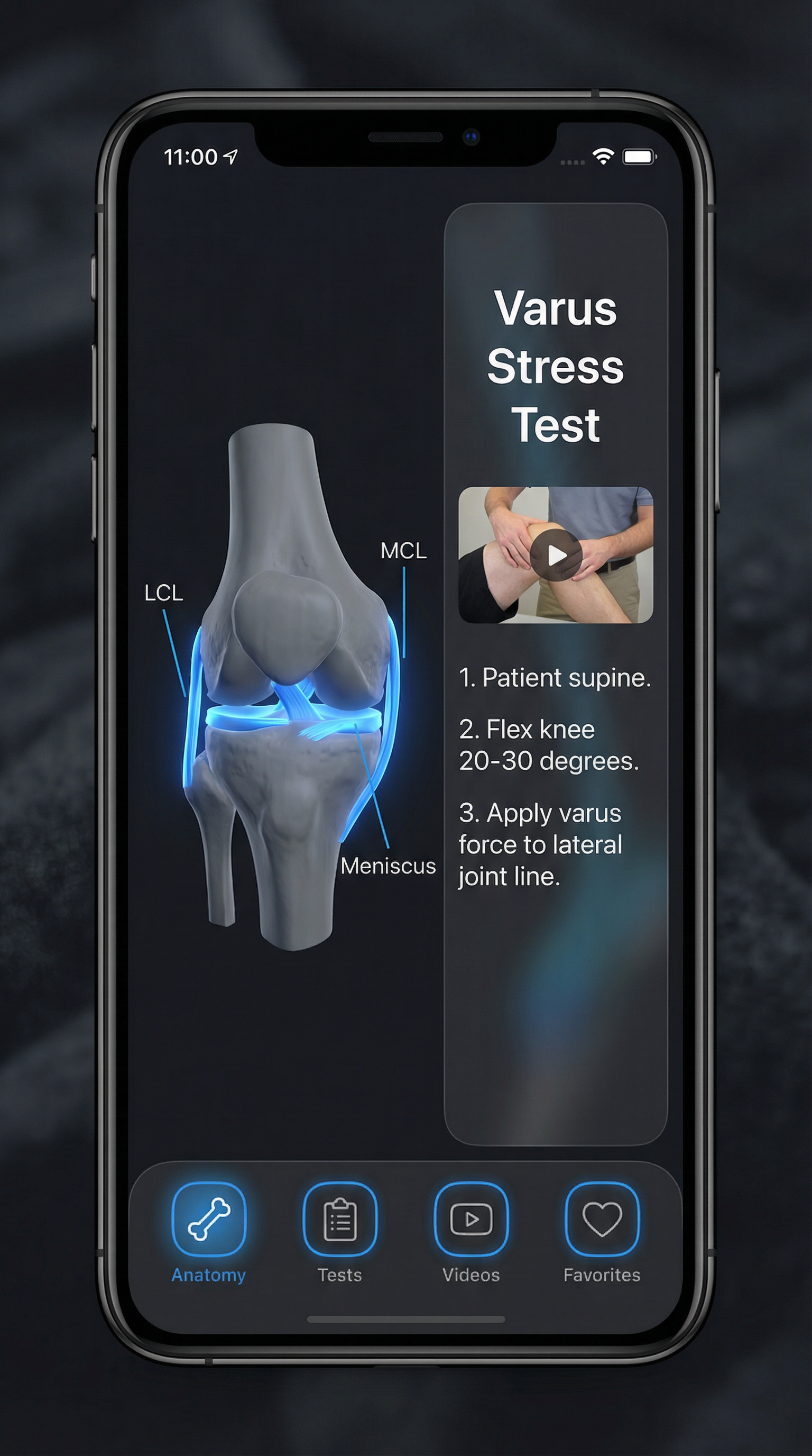 触診・徒手検査アプリ