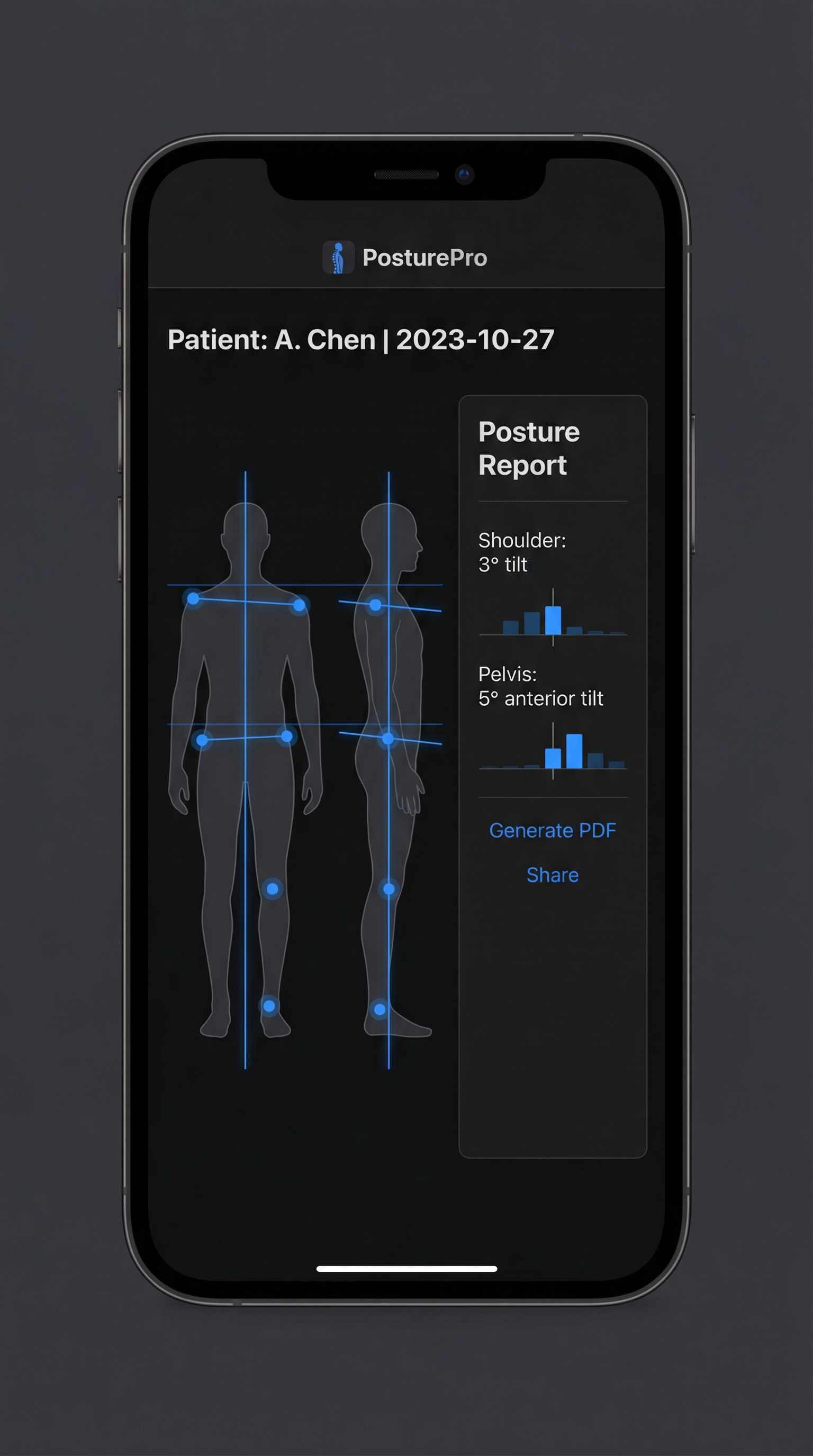 姿勢分析アプリ