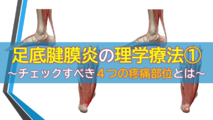 足底腱膜炎の理学療法①～チエックすべき４つの疼痛部位とは～