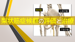 梨状筋症候群の評価と治療