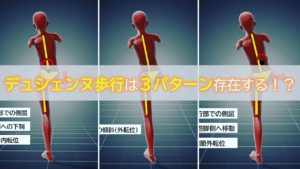 デュシェンヌ歩行は3パターン存在する！？