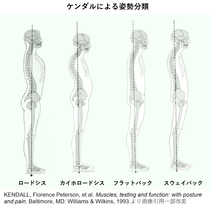 立位姿勢の分類と評価方法 理学療法士による理学療法士のためのブログ