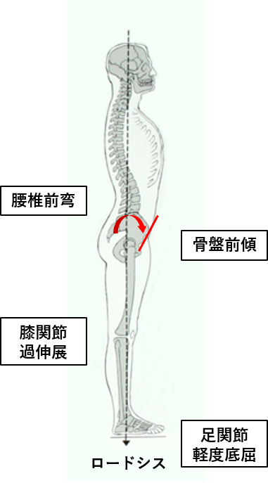 立位姿勢の分類と評価方法 理学療法士による理学療法士のためのブログ