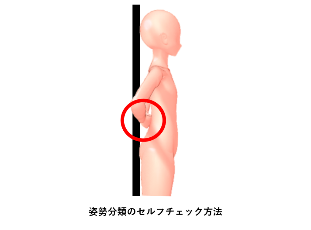 立位姿勢の分類と評価方法 理学療法士による理学療法士のためのブログ