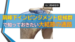 肩峰下インピンジメント症候群で知っておきたい大結節の通路