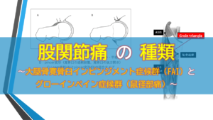 股関節痛の種類〜大腿骨寛骨臼インピンジメント症候群（FAI）とグローインペイン症候群（鼠径部痛）〜