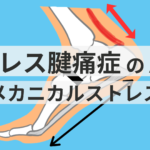 アキレス腱痛症の原因となるメカニカルストレス