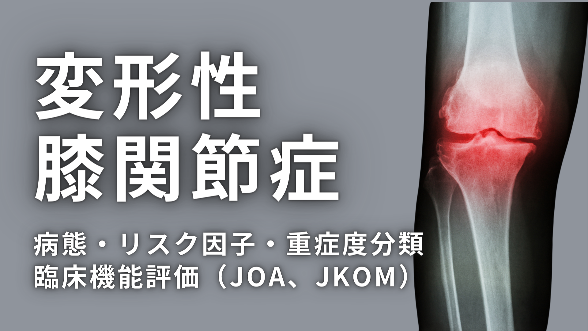 変形性膝関節症の病態、リスク因子、重症度分類、臨床機能評価（JOA、JKOM）