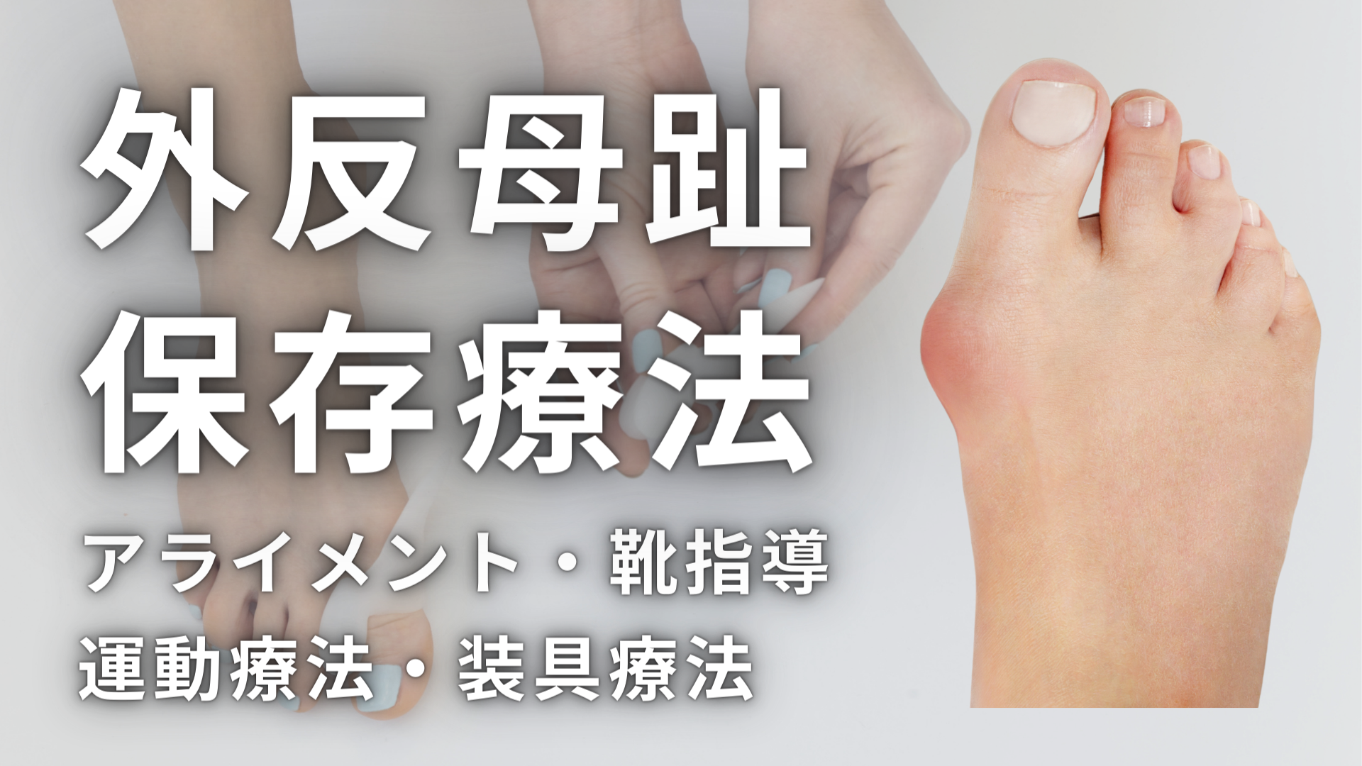 外反母趾の保存療法ーアライメント・靴指導・運動療法・装具療法ー