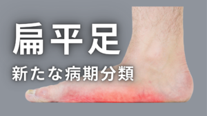 扁平足の定義と新たな病期分類
