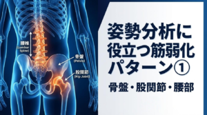 姿勢分析に役立つ筋弱化パターン①ー骨盤・股関節・腰部ー